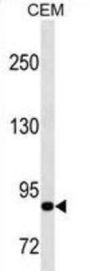 Matrix Metalloproteinase-9 (MMP9) Antibody