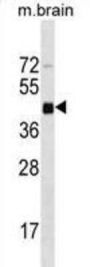 Mouse Irgm1 Antibody