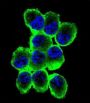 Myelin Basic Protein (MBP) Antibody
