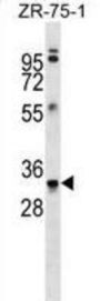 Myelin Basic Protein (MBP) Antibody