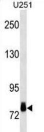RPS6KA3 Antibody