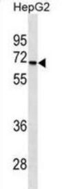 Serine/Threonine Kinase 39 (STK39) Antibody