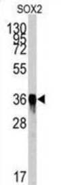 Transcription Factor SOX-2 (SOX2) Antibody