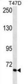 Vitronectin (VTN) Antibody