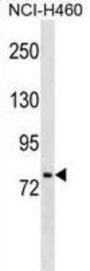 Hepatocyte Nuclear Factor 1 Alpha (HNF1A) Antibody