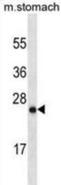 Ly6/PLAUR Domain-Containing Protein 6B (LYPD6B) Antibody