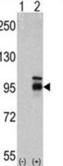 Fibroblast Growth Factor Receptor 4 (FGFR4) Antibody