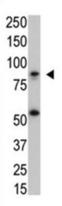 Inhibitor of Nuclear Factor Kappa-B Kinase Subunit Beta (IKK beta) Antibody
