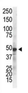 IKK gamma Antibody