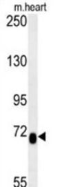 Lebercilin-Like Protein (LCA5L) Antibody