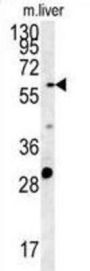 POTE Ankyrin Domain Family Member B (POTEB) Antibody