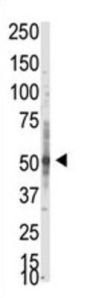 Protein Arginine Methyltransferase 3 (PRMT3) Antibody