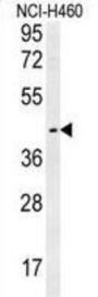Lysosomal-Associated Transmembrane Protein 5 (LAPTM5) Antibody