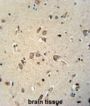 Magnesium Transporter NIPA4 (NIPA4) Antibody