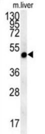 Magnesium Transporter NIPA4 (NIPA4) Antibody