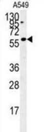 PCNA-Interacting Partner (C12orf48) Antibody