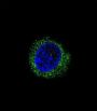 Alpha-2-HS-Glycoprotein (AHSG) Antibody