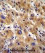 Alpha-2-HS-Glycoprotein (AHSG) Antibody