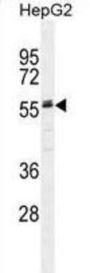 Alpha-2-HS-Glycoprotein (AHSG) Antibody