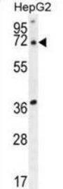 ACOT11 Antibody