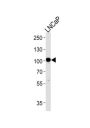 Neprilysin / NEP (MME) Antibody