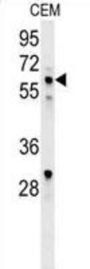 DNA-Binding Protein Ikaros (IKZF1) Antibody