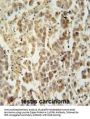 Leucine Zipper Protein 4 (LUZP4) Antibody