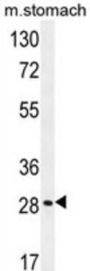 Breast Cancer Metastasis-Suppressor 1-Like Protein (BRMS1L) Antibody