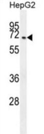 Coiled-Coil Domain-Containing Protein 19 (CCDC19) Antibody
