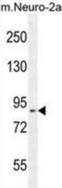 DDX11 Antibody