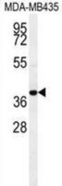 C-C Chemokine Receptor Type 8 (CCR8) Antibody