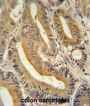 AP-3 Complex Subunit Sigma-1 (AP3S1) Antibody