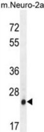 AP-3 Complex Subunit Sigma-1 (AP3S1) Antibody