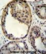 RAC-Alpha Serine/threonine-Protein Kinase (AKT1) Antibody