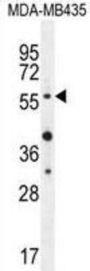 RAC-Alpha Serine/threonine-Protein Kinase (AKT1) Antibody