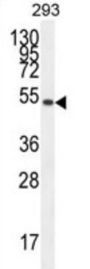Immunoglobulin Superfamily Member 5 (IGSF5) Antibody