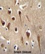 F-Box Only Protein 39 (FBXO39) Antibody