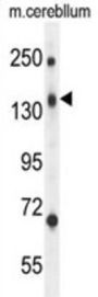 CD109 Antibody