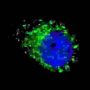 Microtubule-Associated Proteins 1A/1B Light Chain 3B (MAP1LC3A/B) Antibody