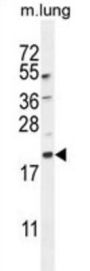 Microtubule-Associated Proteins 1A/1B Light Chain 3B (MAP1LC3A/B) Antibody