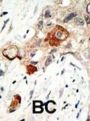Ubiquitin Carrier Protein 9 (UBC9) Antibody
