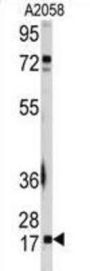 Ubiquitin Carrier Protein 9 (UBC9) Antibody