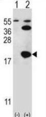 Ubiquitin Carrier Protein 9 (UBC9) Antibody