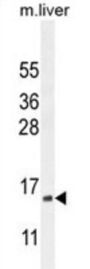 Complexin-3 (CPLX3) Antibody