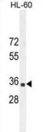B3GNT4 Antibody