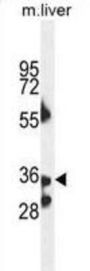 B3GNT4 Antibody