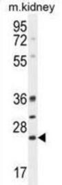 B-Cell Lymphoma/leukemia 10 (BCL10) Antibody