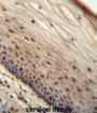 PYM Homolog 1 Exon Junction Complex-Associated Factor (WIBG) Antibody