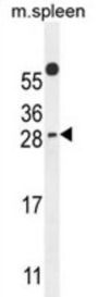 PYM Homolog 1 Exon Junction Complex-Associated Factor (WIBG) Antibody