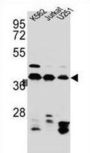 Heterogeneous Nuclear Ribonucleoprotein C1/C2 (HNRNPC) Antibody